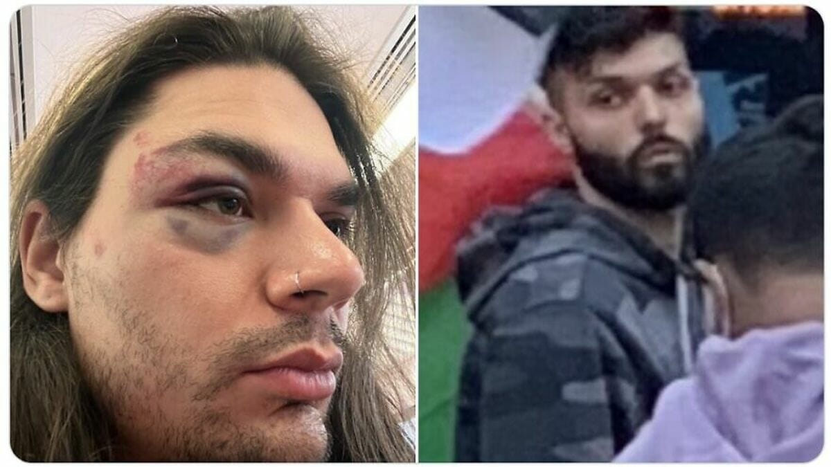 Matthew Greenman wurde auf der antisemitischen Demonstration in New York angegriffen